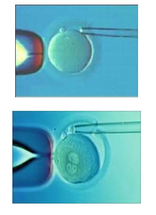 辅助生殖技术周期请假申请指南