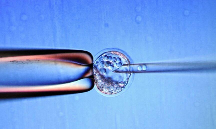 辅助生殖技术 试管婴儿费用分析