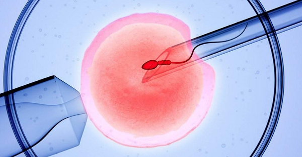 辅助生殖技术医院选择标准